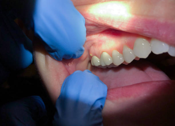 Best Pediatric Emergency Dentist in Riverdale, IL